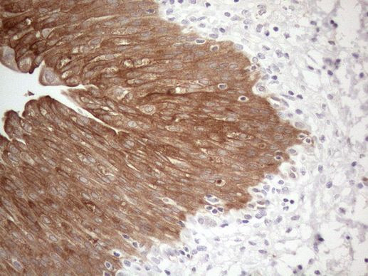 CAMK2B Antibody in Immunohistochemistry (Paraffin) (IHC (P))