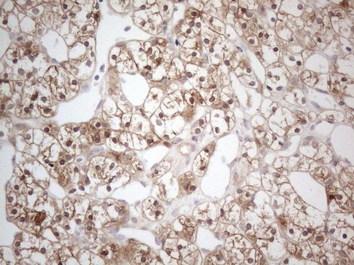 CAMK2B Antibody in Immunohistochemistry (Paraffin) (IHC (P))