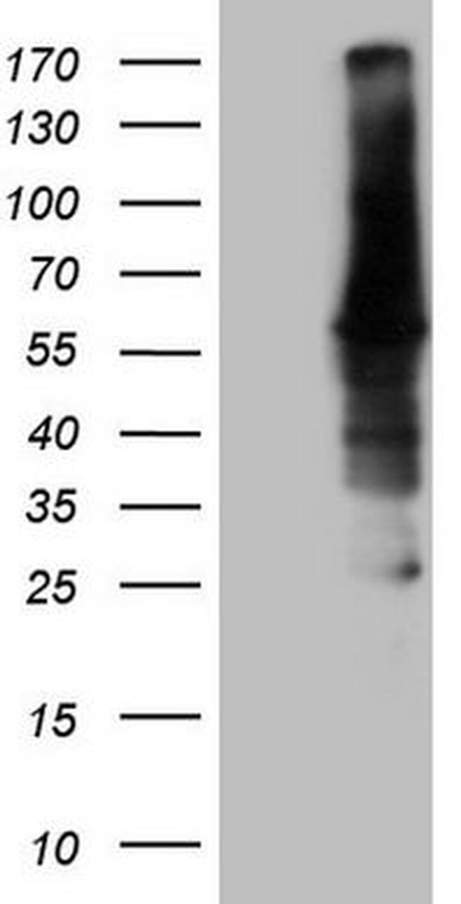 CAMK2B Antibody in Western Blot (WB)