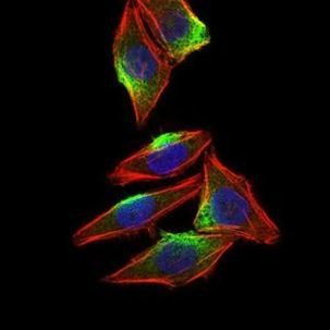 CaMKIV Antibody in Immunocytochemistry (ICC/IF)