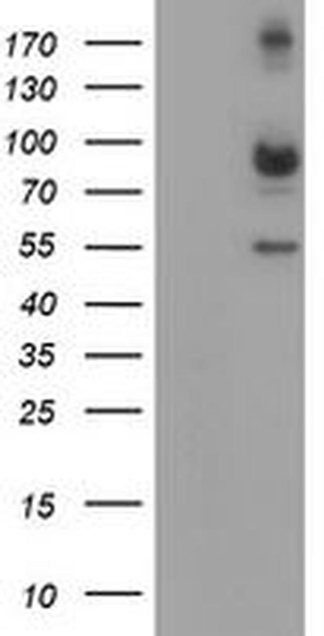 CAPN2 Antibody in Western Blot (WB)
