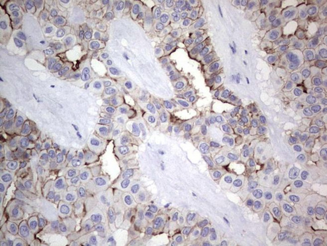 CAPN5 Antibody in Immunohistochemistry (Paraffin) (IHC (P))