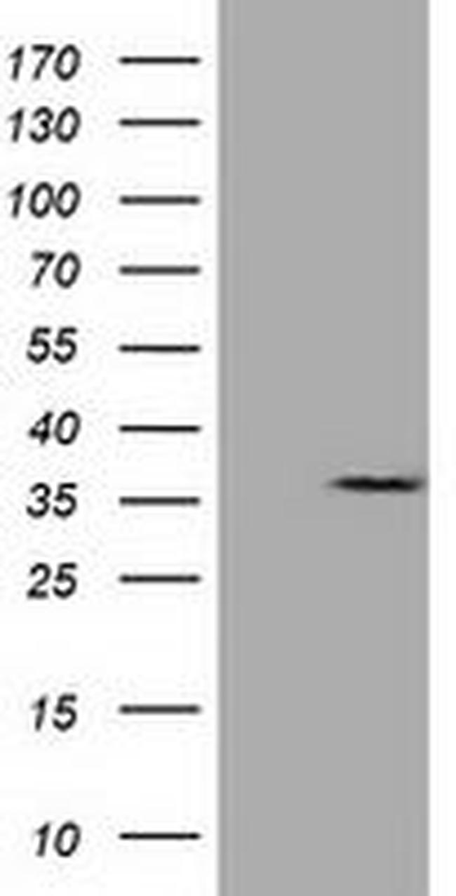 CAPZA1 Antibody in Western Blot (WB)