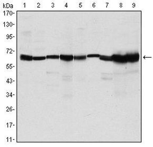 PRMT4 Antibody in Western Blot (WB)