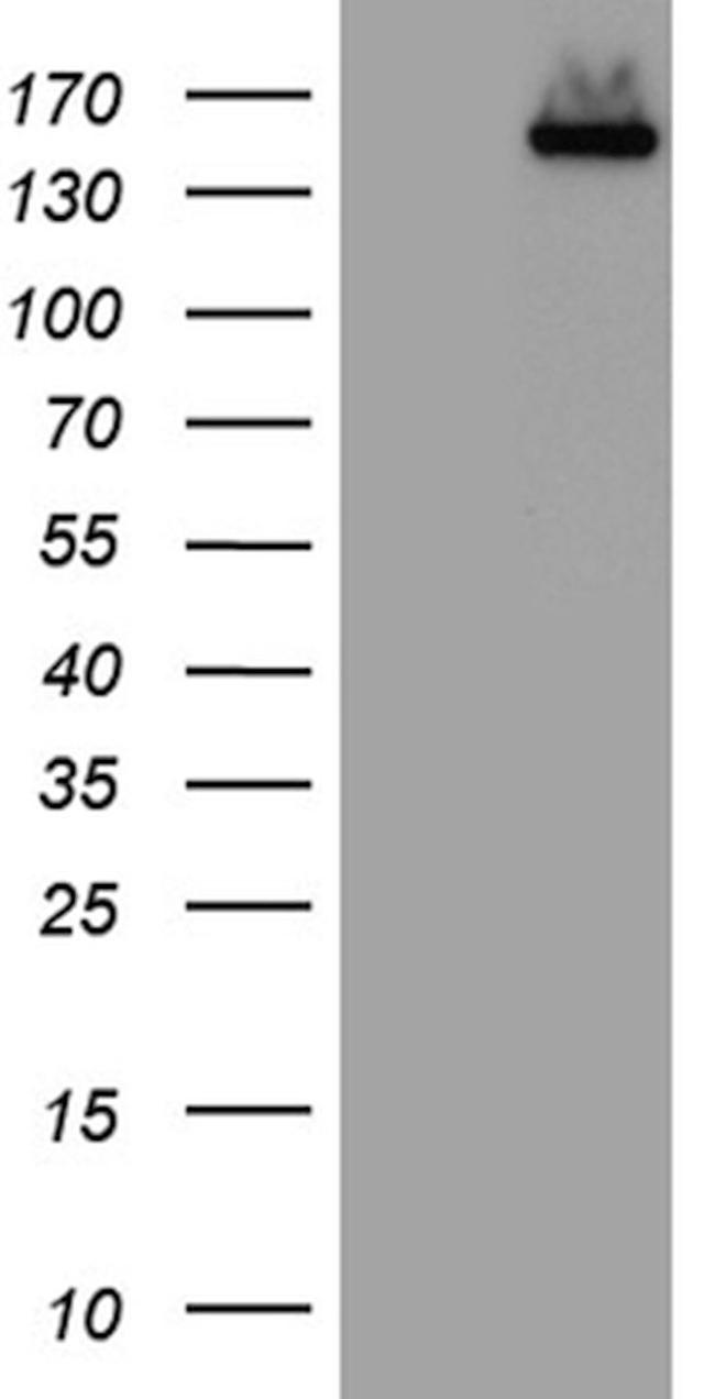 Cas9 Antibody in Western Blot (WB)