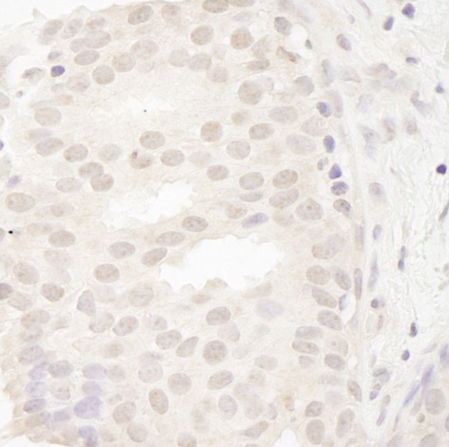 CASC5 Antibody in Immunohistochemistry (IHC)