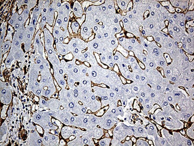 CAV1 Antibody in Immunohistochemistry (Paraffin) (IHC (P))