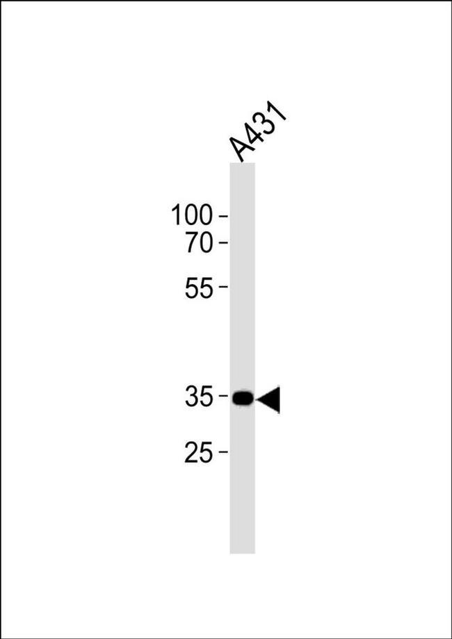 CNR2 Antibody in Western Blot (WB)