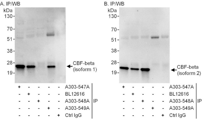 CBF-beta Antibody in Immunoprecipitation (IP)