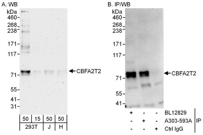 CBFA2T2 Antibody in Western Blot (WB)