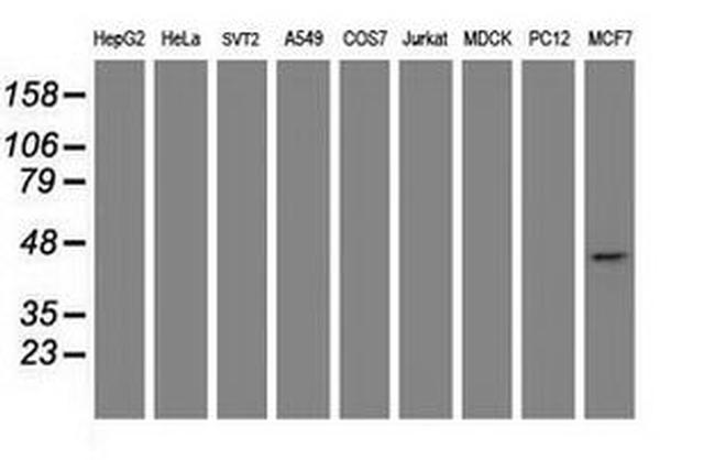 CBX8 Antibody in Western Blot (WB)