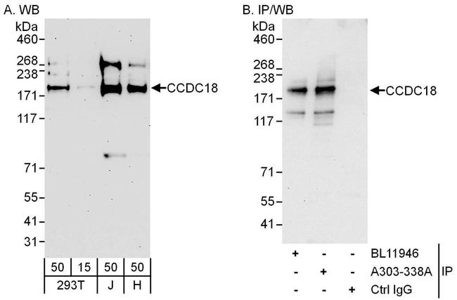 CCDC18 Antibody in Western Blot (WB)