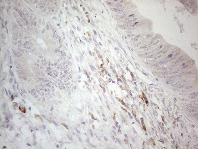 CCDC36 Antibody in Immunohistochemistry (Paraffin) (IHC (P))