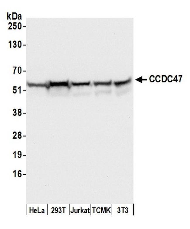 CCDC47 Antibody in Western Blot (WB)