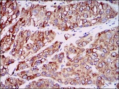 MCP-1 Antibody in Immunohistochemistry (Paraffin) (IHC (P))