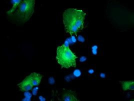CCM2 Antibody in Immunocytochemistry (ICC/IF)