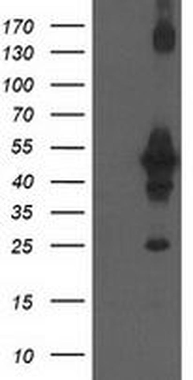 CCM2 Antibody in Western Blot (WB)