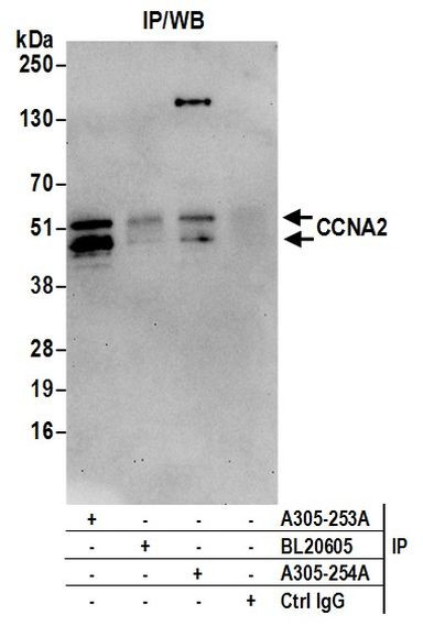 CCNA2/Cyclin A2 Antibody in Immunoprecipitation (IP)