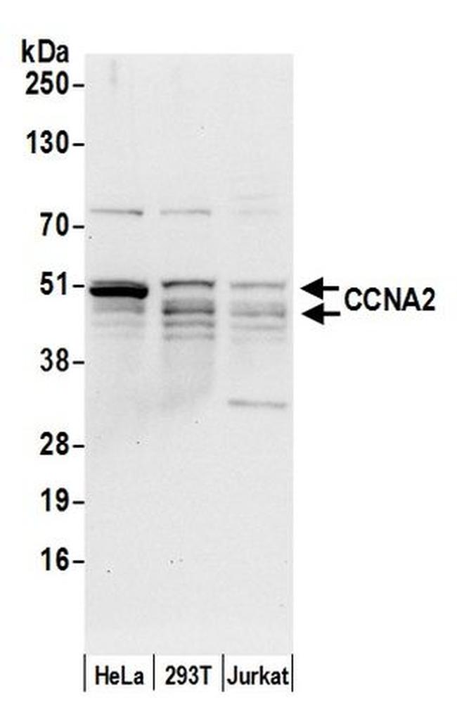 CCNA2/Cyclin A2 Antibody in Western Blot (WB)