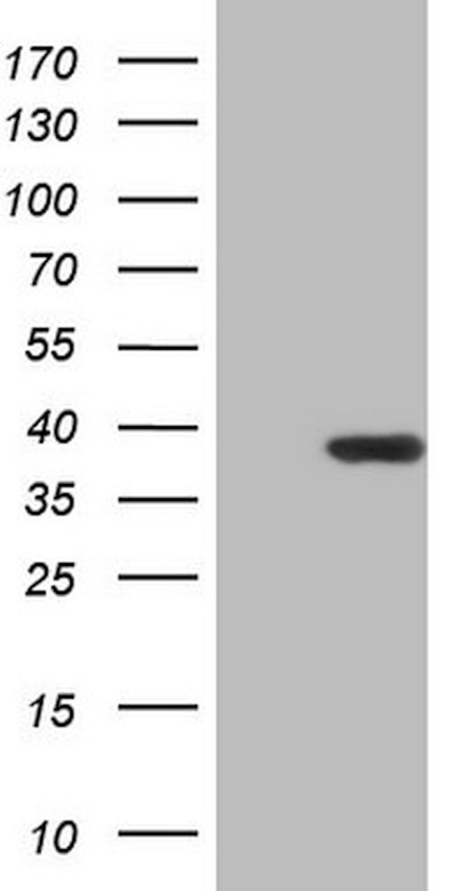 CCND2 Antibody in Western Blot (WB)