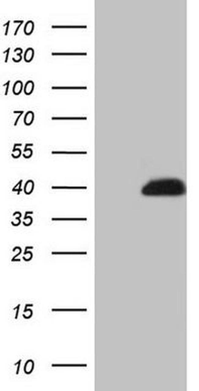 CCND2 Antibody in Western Blot (WB)