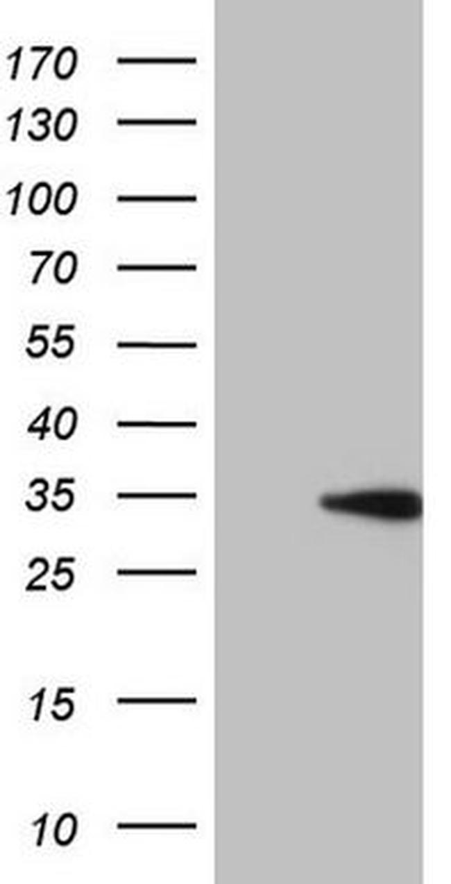 CCND2 Antibody in Western Blot (WB)