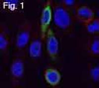 CCR4 Antibody in Immunocytochemistry (ICC/IF)