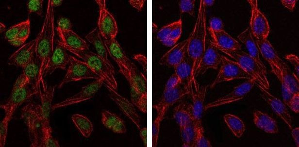 TCP-1 beta Antibody in Immunocytochemistry (ICC/IF)