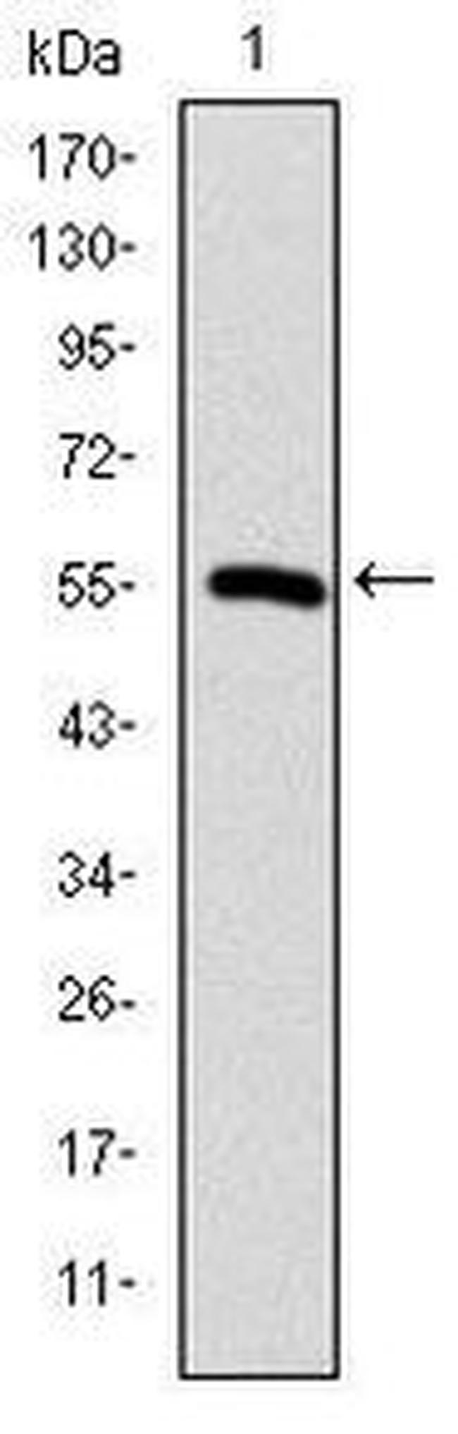 TCP-1 beta Antibody in Western Blot (WB)