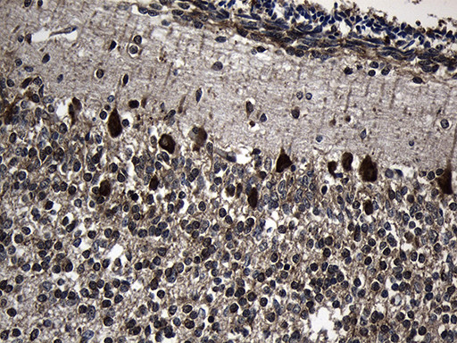 CCT4 Antibody in Immunohistochemistry (Paraffin) (IHC (P))