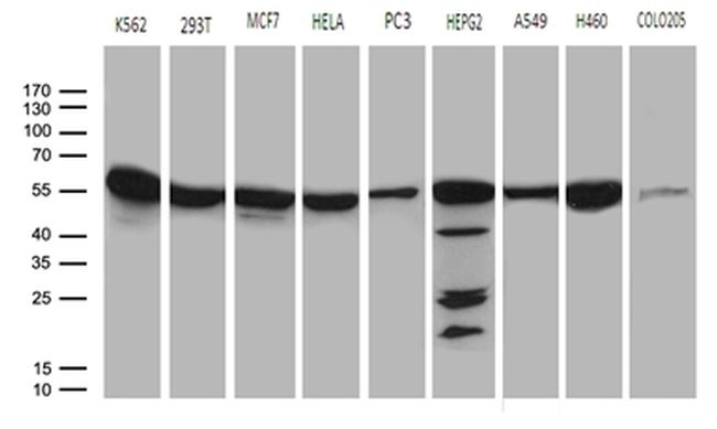 CCT4 Antibody in Western Blot (WB)