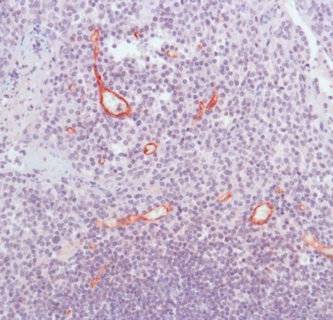 CD105 Antibody in Immunohistochemistry (IHC)