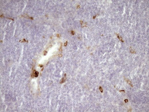 CD13 Antibody in Immunohistochemistry (Paraffin) (IHC (P))