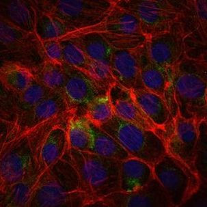 SSEA1 Antibody in Immunocytochemistry (ICC/IF)