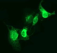 CD163 Antibody in Immunocytochemistry (ICC/IF)