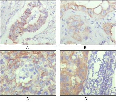 CD166 Antibody in Immunohistochemistry (Paraffin) (IHC (P))