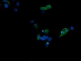 CD1C Antibody in Immunocytochemistry (ICC/IF)