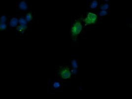 CD1C Antibody in Immunocytochemistry (ICC/IF)