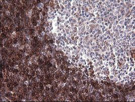 CD1C Antibody in Immunohistochemistry (Paraffin) (IHC (P))