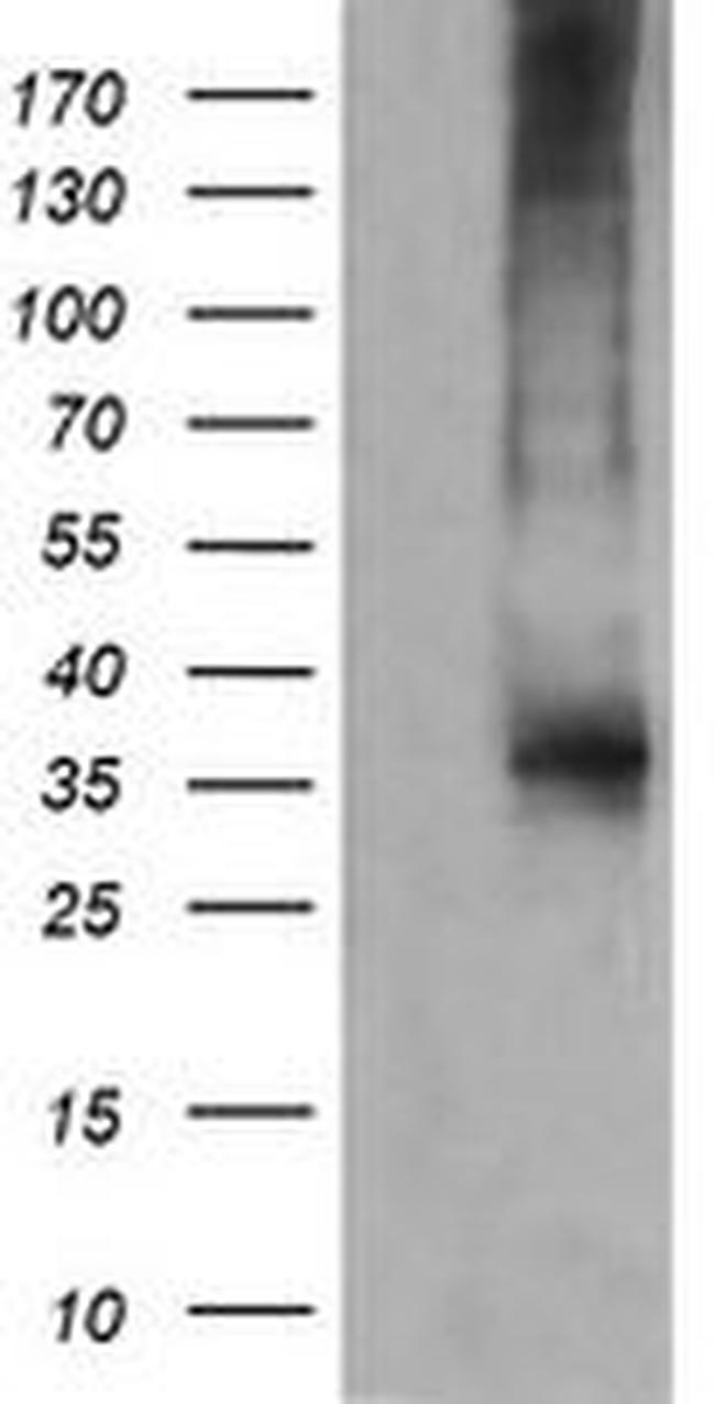 CD1C Antibody in Western Blot (WB)