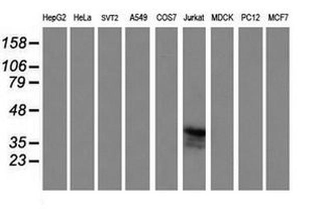 CD1C Antibody in Western Blot (WB)