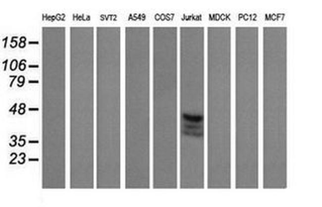 CD1C Antibody in Western Blot (WB)