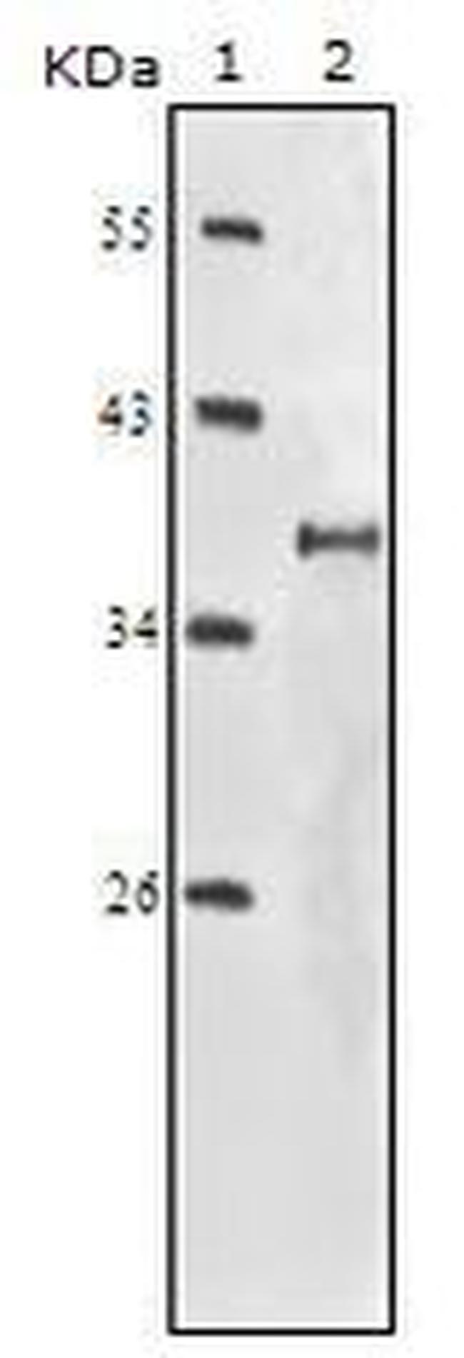 IGF1R beta Antibody in Western Blot (WB)