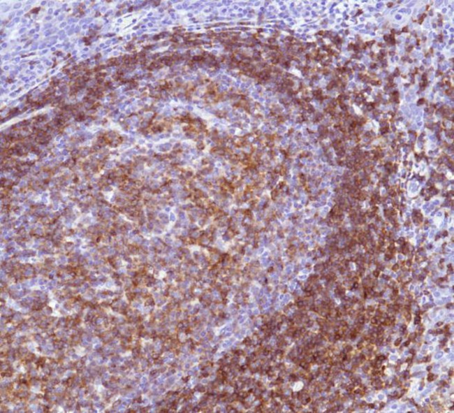 CD22 Antibody in Immunohistochemistry (Paraffin) (IHC (P))