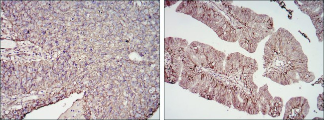 B7-H3 Antibody in Immunohistochemistry (Paraffin) (IHC (P))