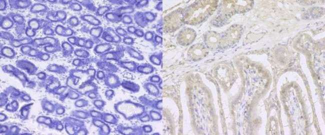 ITGB1 Antibody in Immunohistochemistry (Paraffin) (IHC (P))