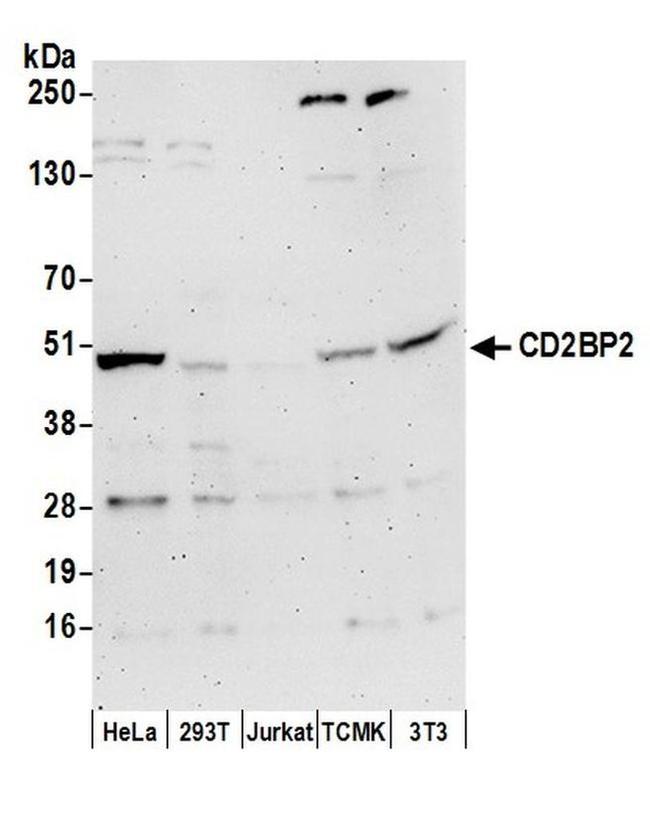 CD2BP2 Antibody in Western Blot (WB)