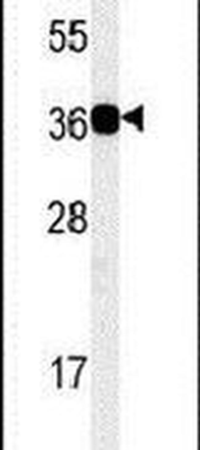 CD300b Antibody in Western Blot (WB)