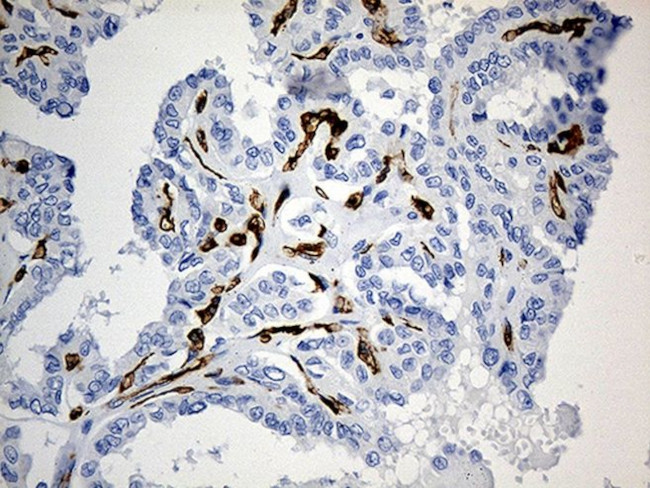 CD34 Antibody in Immunohistochemistry (Paraffin) (IHC (P))