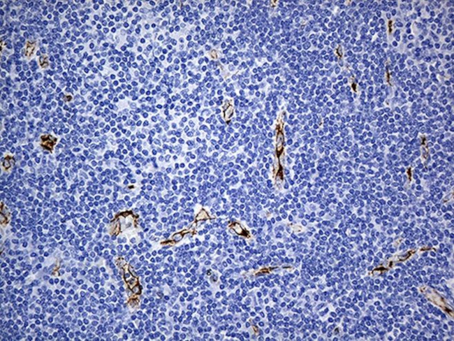 CD34 Antibody in Immunohistochemistry (Paraffin) (IHC (P))